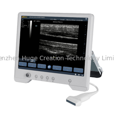 中国 TS20デジタルの産婦人科部のための診断超音波システム サプライヤー