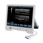中国 TS20デジタルの産婦人科部のための診断超音波システム 工場